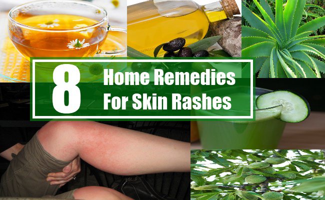 8 Home Remedies For Skin Rashes Search Home Remedy