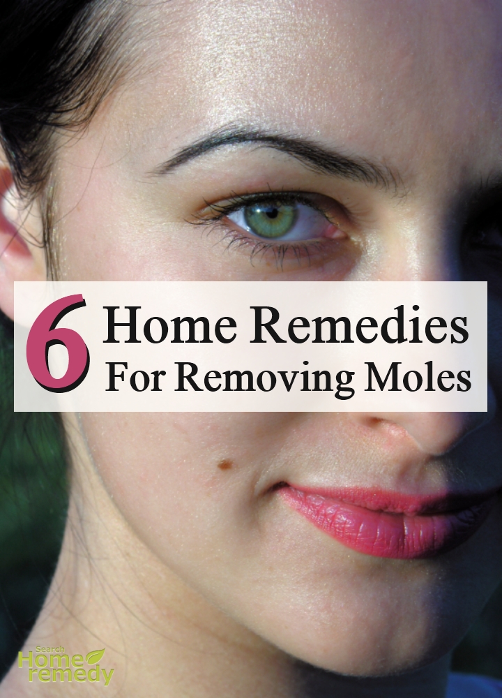 Home Remedies For Removing Moles
