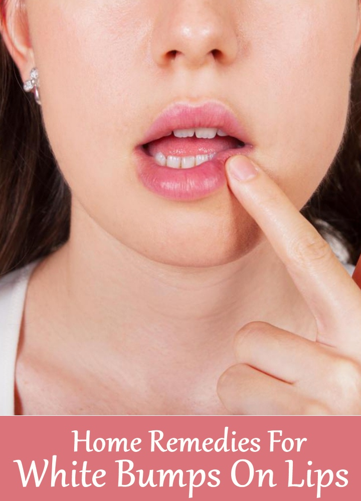 Home Remedies For White Bumps On Lips