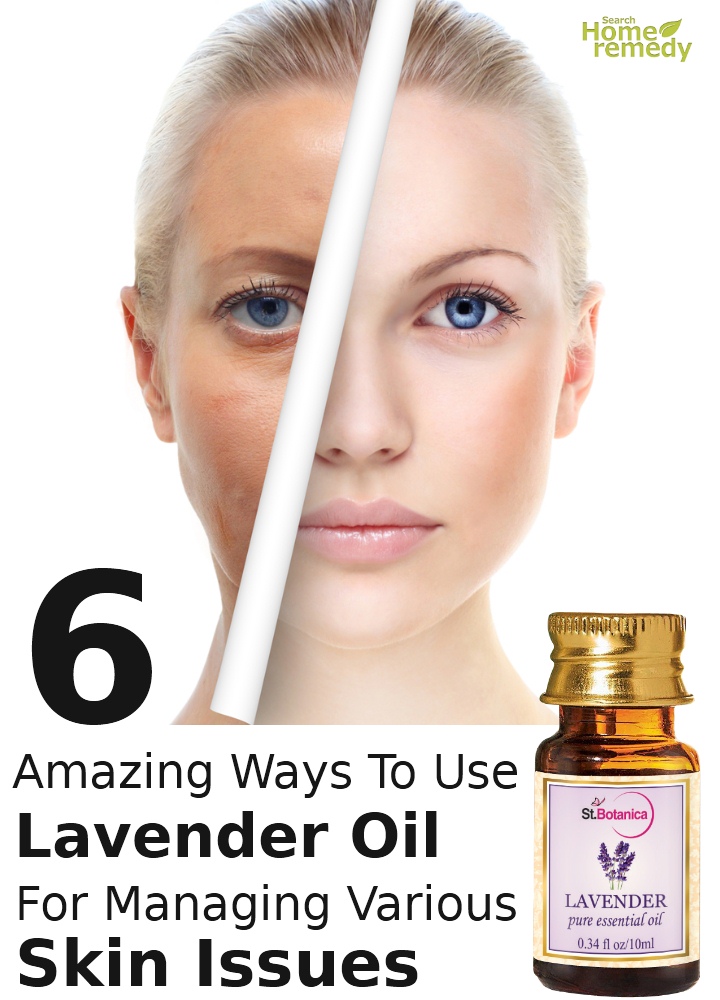 Ways To Use Lavender Oil For Managing Various Skin Issues